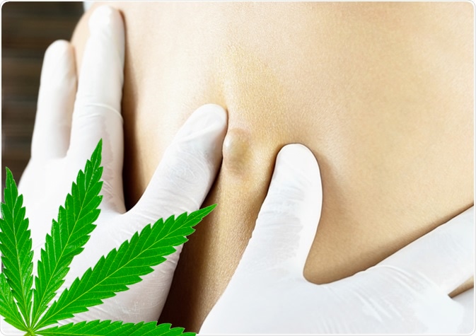 skin disease cannabis
